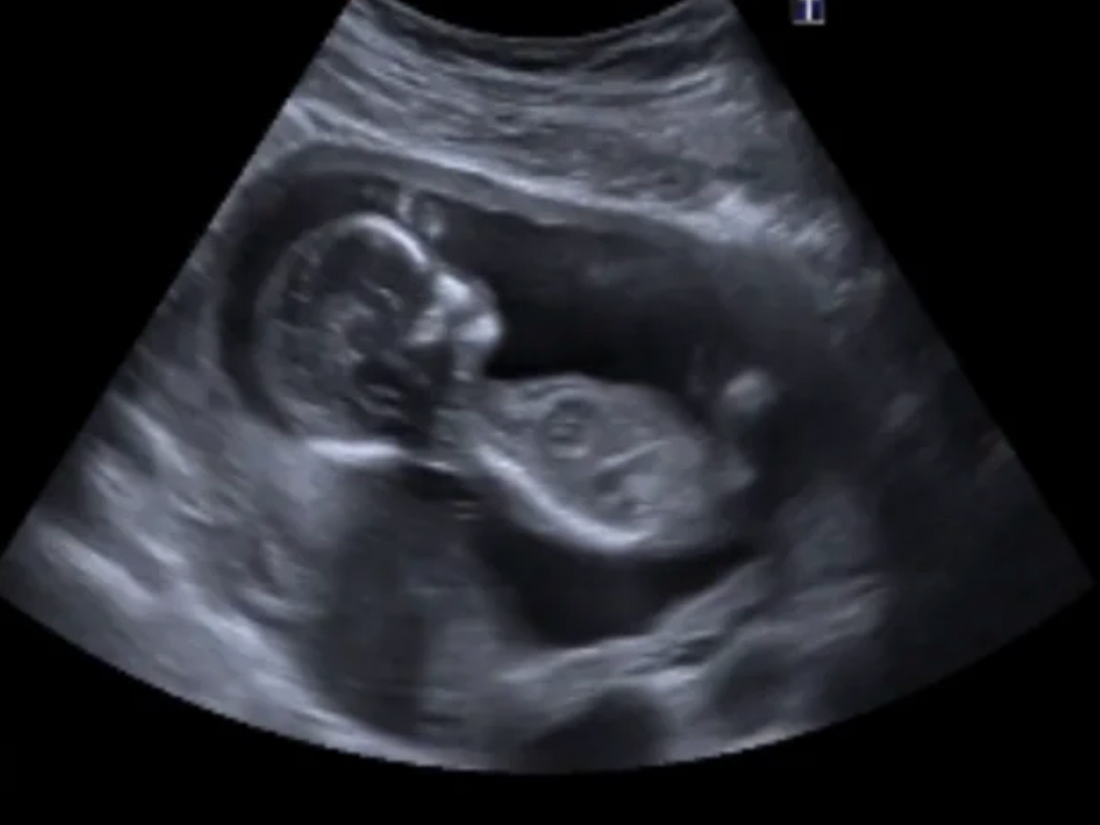 Our Journey to Pregnancy After Vaginismus