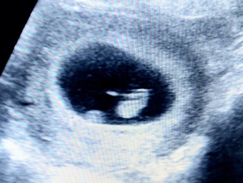 A Wonderful and Personal Journey to Pregnancy